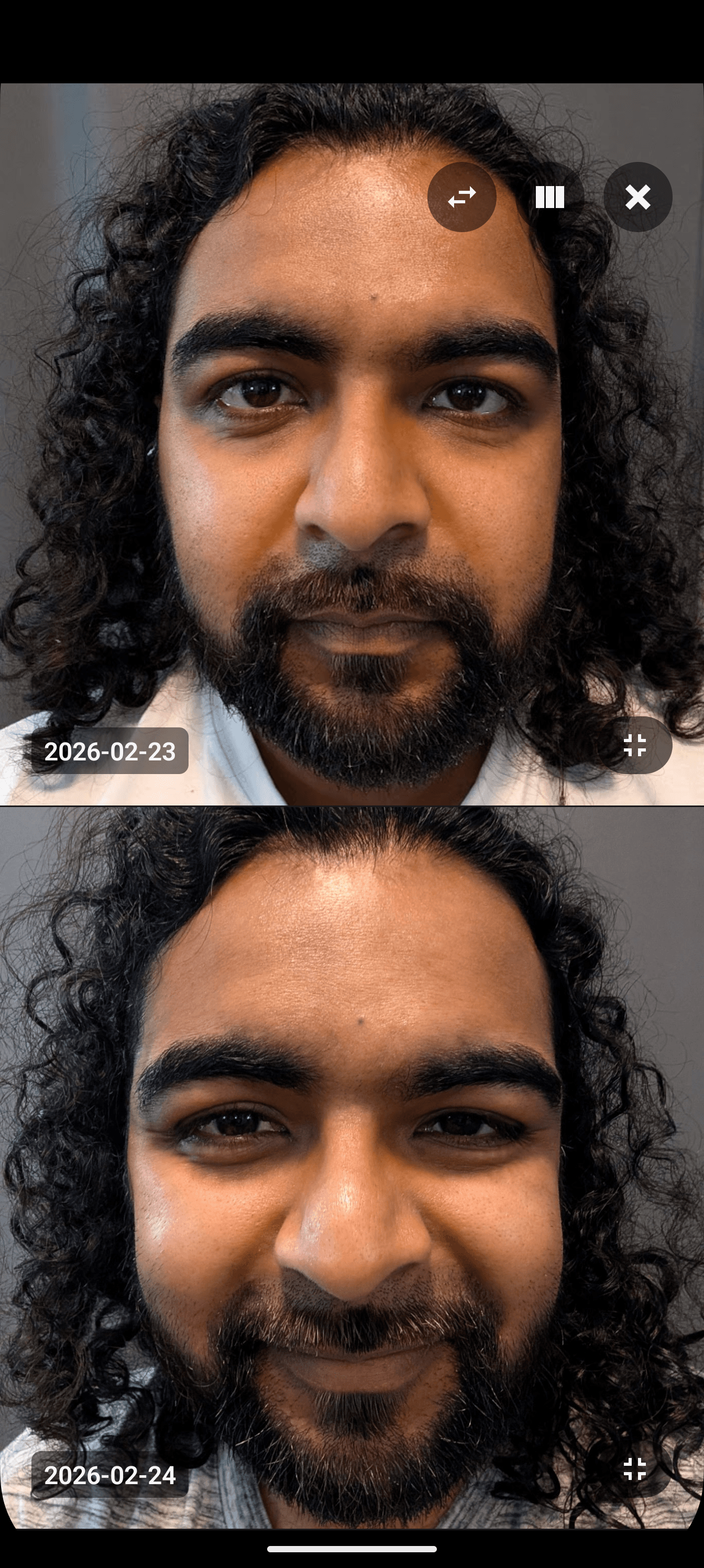 Photo Comparison
